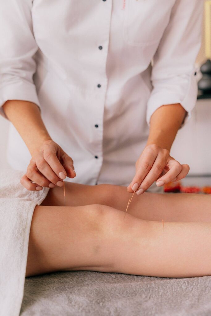 Acupuncture knee