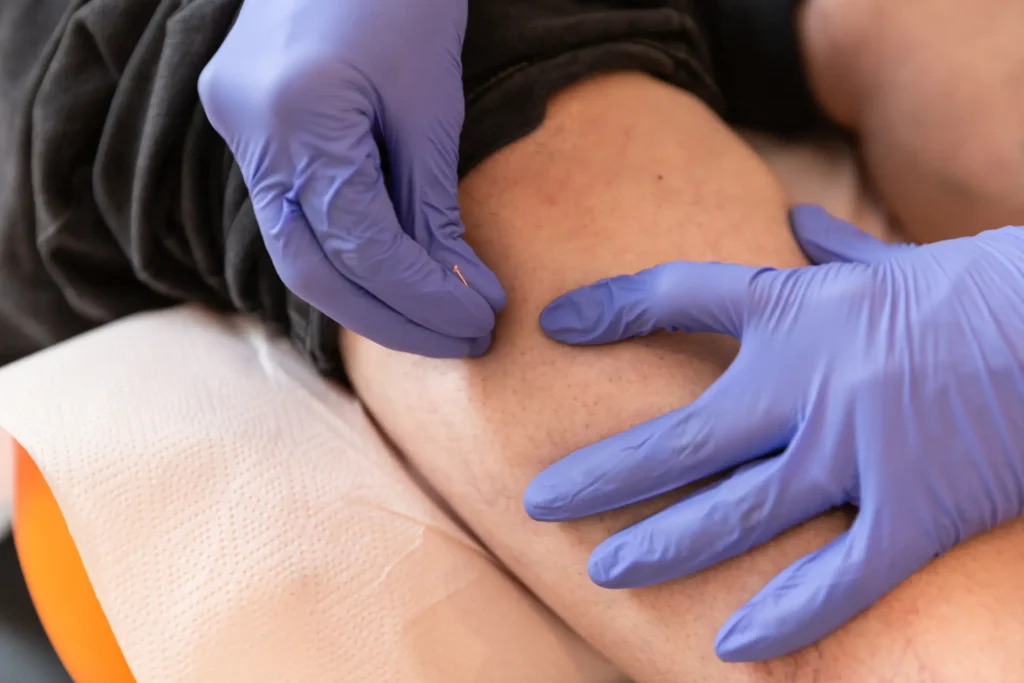 IMS Therapy service